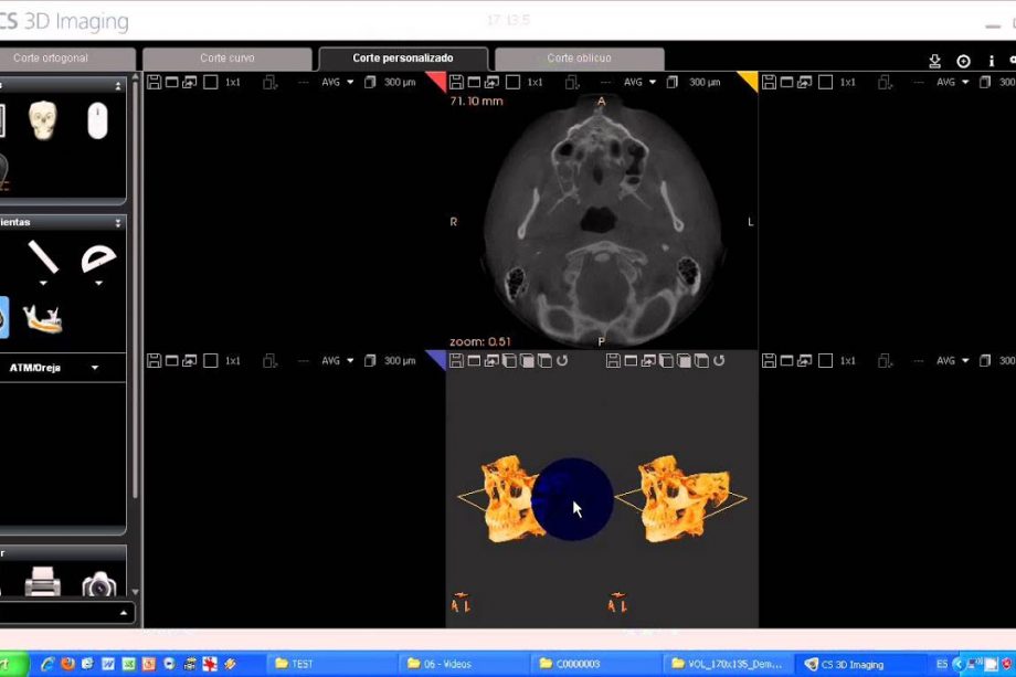 Cs Imaging centroradiologico3D – Advanced Imaging Pro